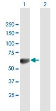 Anti-TOM1 antibody produced in mouse purified immunoglobulin, buffered aqueous solution