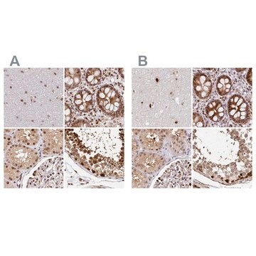 Anti-PSMD7 antibody produced in rabbit Prestige Antibodies&#174; Powered by Atlas Antibodies, affinity isolated antibody, buffered aqueous glycerol solution