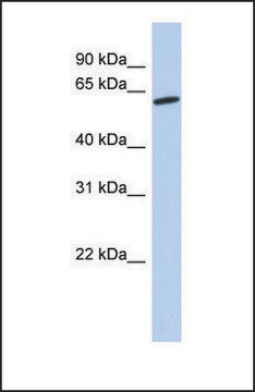 抗GPR75抗体 ウサギ宿主抗体 affinity isolated antibody