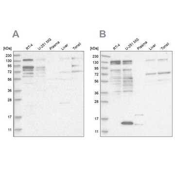 Anty-PUM1 Prestige Antibodies&#174; Powered by Atlas Antibodies, affinity isolated antibody