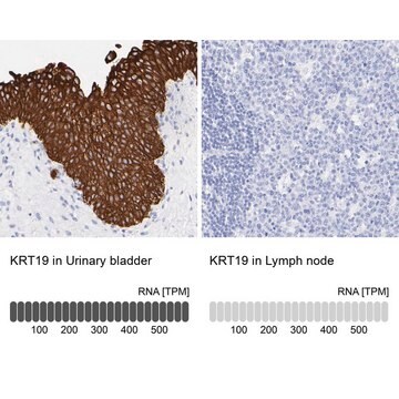 Anti-KRT19 antibody produced in rabbit Prestige Antibodies&#174; Powered by Atlas Antibodies, affinity isolated antibody, buffered aqueous glycerol solution