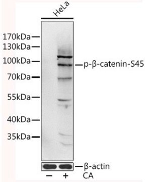 Anti-Phospho-CTNNB1-S45 antibody produced in rabbit