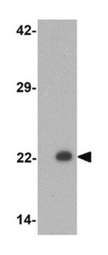 Przeciwciało anty-PHOX2B from rabbit, purified by affinity chromatography