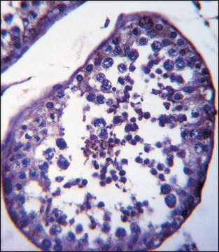 ANTI-SPATA18 (N-TERM) antibody produced in rabbit IgG fraction of antiserum, buffered aqueous solution