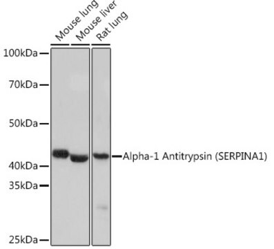 Anti-Alpha-1 Antitrypsin (SERPINA1) Antibody, clone 1J3E7, Rabbit Monoclonal