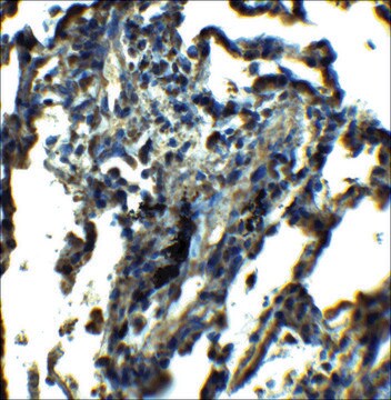 Anti-NDFIP1 antibody produced in rabbit affinity isolated antibody, buffered aqueous solution