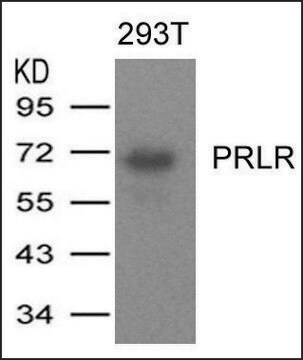 Anti-PRLR antibody produced in rabbit affinity isolated antibody