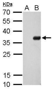 Monoklonalnyznacznik anty-S clone GT727, affinity isolated antibody