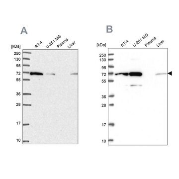 Anty-IRGQ Prestige Antibodies&#174; Powered by Atlas Antibodies, affinity isolated antibody