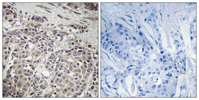 Anti-AMPK1 antibody produced in rabbit affinity isolated antibody