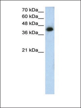 Anti-MTUS1 antibody produced in rabbit IgG fraction of antiserum