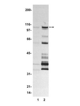 FKHR Protein, 100 &#181;g N-terminal, Glutathione-Stransferase (GST) tagged, full-length fusion protein corresponding to human FKHR.