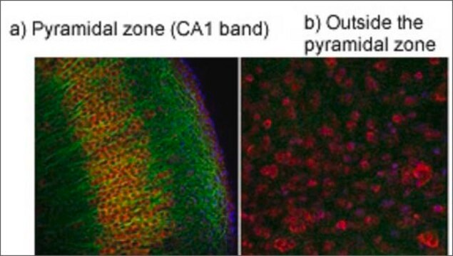 Anti-TRPV4 antibody produced in rabbit affinity isolated antibody