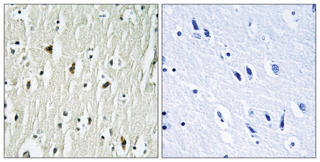 Anti-CSK antibody produced in rabbit affinity isolated antibody