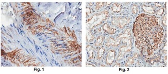 Anti-DDR2 Antibody, clone 2B12.1 clone 2B12.1, from mouse