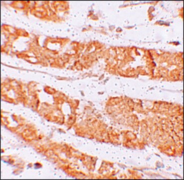 Anti-HMMR antibody produced in rabbit affinity isolated antibody