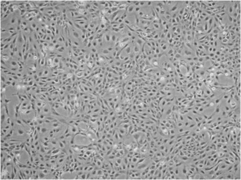 Linea di cellule stellate epatiche umane LX-2 a highly suitable model of human hepatic fibrosis