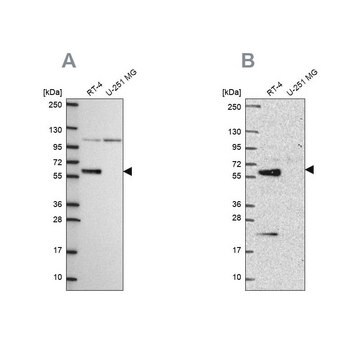 Anti-IRF6 antibody produced in rabbit Prestige Antibodies&#174; Powered by Atlas Antibodies, affinity isolated antibody