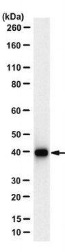 Anti-SIRT2 Antibody, clone 7G5