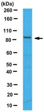 Anti-CDT2 Antibody serum, from rabbit