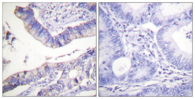 抗-BCL-2 兔抗 affinity isolated antibody