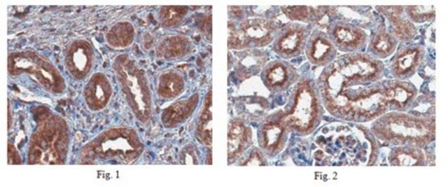 Anti-Pinch-1 Antibody, clone 9D2.1 clone 9D2.1, from mouse