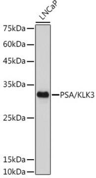 Anti-PSA/KLK3 Antibody, clone 8K9R4, Rabbit Monoclonal