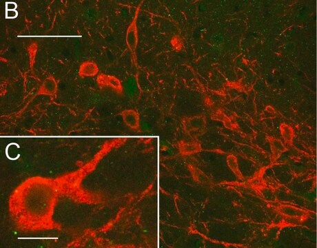 Anti-CAR Antibody, clone RmcB clone RmcB, Upstate&#174;, from mouse