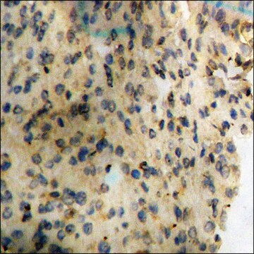 Anti-phospho-Synuclein-&#945; (pTyr133) antibody produced in rabbit affinity isolated antibody