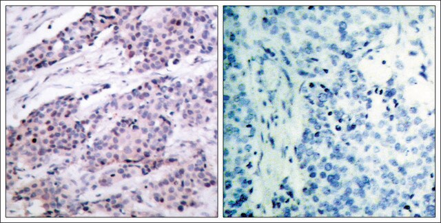 Anti-BCL2 (Ab-56) antibody produced in rabbit affinity isolated antibody