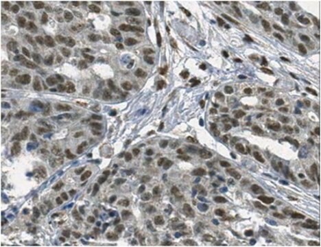 Anti-FOXL1 Antibody from rabbit, purified by affinity chromatography