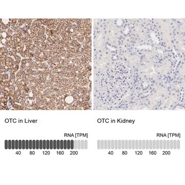 抗OTC ウサギ宿主抗体 Prestige Antibodies&#174; Powered by Atlas Antibodies, affinity isolated antibody, buffered aqueous glycerol solution