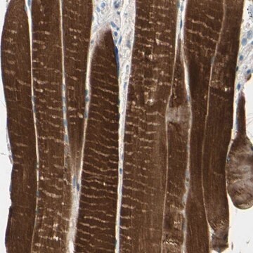 抗TPM3抗体 ウサギ宿主抗体 Prestige Antibodies&#174; Powered by Atlas Antibodies, affinity isolated antibody, buffered aqueous glycerol solution