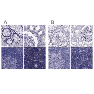 Anti-PSMB11 antibody produced in rabbit Prestige Antibodies&#174; Powered by Atlas Antibodies, affinity isolated antibody