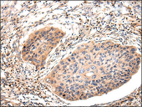 Anti-Lambda Light chain affinity isolated antibody