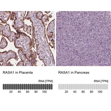 Anti-RASA1 antibody produced in rabbit Prestige Antibodies&#174; Powered by Atlas Antibodies, affinity isolated antibody