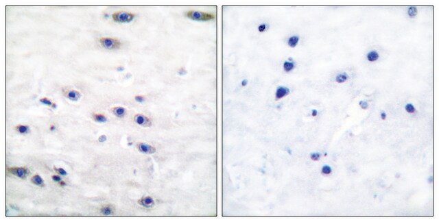 Anti-Tyrosine Hydroxylase, N-Terminal antibody produced in rabbit affinity isolated antibody