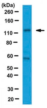 Anti-CDKL5 NT Antibody from rabbit, purified by affinity chromatography