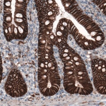 Monoclonal Anti-CTNNB1 antibody produced in mouse Prestige Antibodies&#174; Powered by Atlas Antibodies, clone CL3691, purified immunoglobulin, buffered aqueous glycerol solution