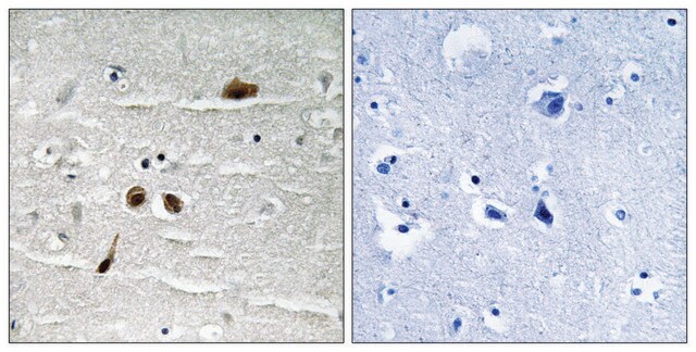 Anti-phospho-MDC1 (pSer513) antibody produced in rabbit affinity isolated antibody