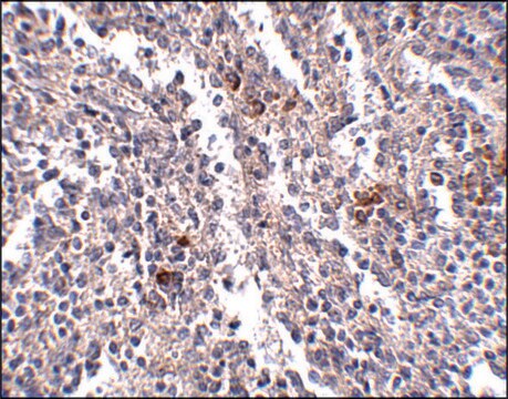 Anti-SYPL2 antibody produced in rabbit affinity isolated antibody, buffered aqueous solution