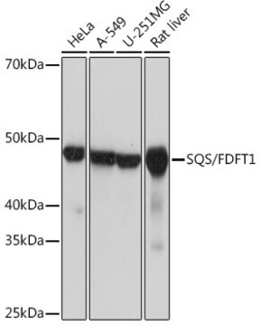 Anti-SQS/FDFT1 Antibody, clone 4W10J4, Rabbit Monoclonal