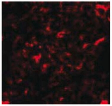 Anti-NANOS2 Antibody from rabbit, purified by affinity chromatography