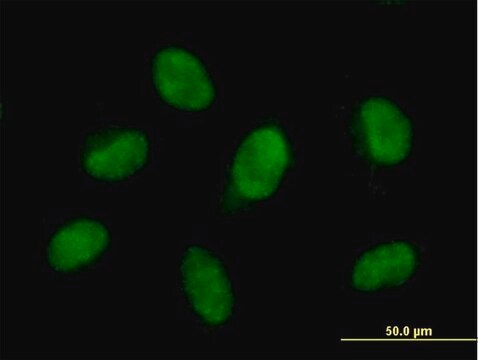 Anti-FBXO28 antibody produced in mouse purified immunoglobulin, buffered aqueous solution