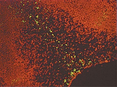 Kit de detección de la apoptosis in situ con fluoresceína ApopTag The ApopTag Fluorescein In Situ Apoptosis Detection Kit detects apoptotic cells in situ by the indirect TUNEL method, utilizing an anti-digoxigenin antibody that is conjugated to a Fluorescein reporter molecule.