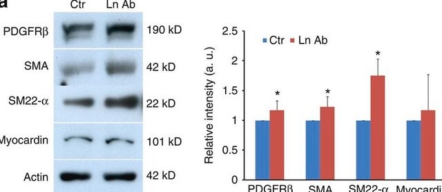 Anticorpo monoclonale anti-actina, &#945;-muscolo liscio clone 1A4, purified from hybridoma cell culture