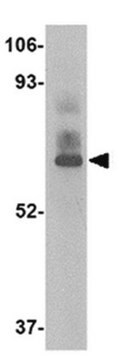 Anti-LGP2 Antibody from rabbit, purified by affinity chromatography