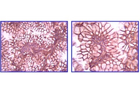 Anti-Laminin-Gamma-1-Antikörper, Klon A5 clone A5, Chemicon&#174;, from rat