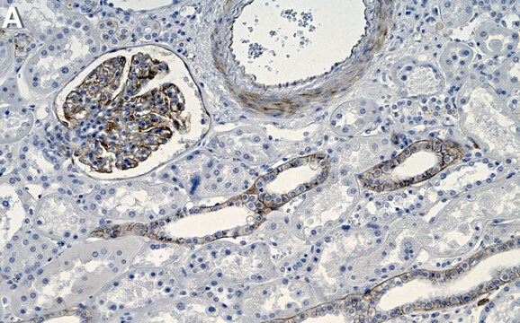 Anti-THSD7A Antibody, clone 2F15-L1 ZooMAb&#174; Rabbit Monoclonal recombinant, expressed in HEK 293 cells