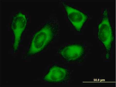 Anti-HARS antibody produced in mouse purified immunoglobulin, buffered aqueous solution